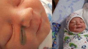 Rusya'da doktorlar doğum sırasında bebeğin yüzünü kesti !